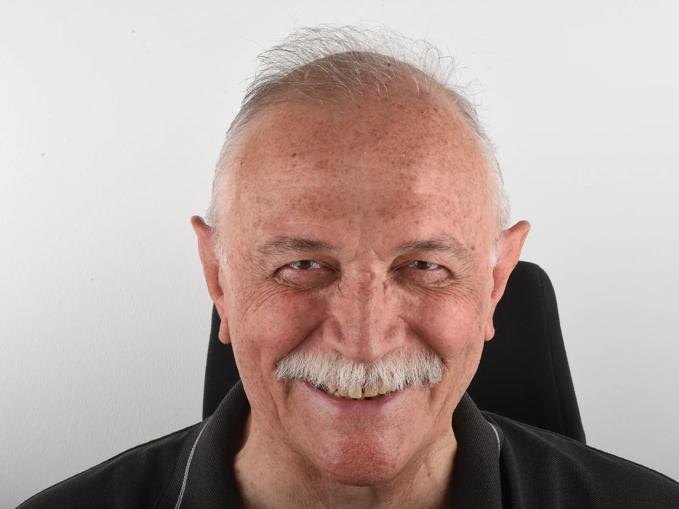 All-on-4 implant tedavisi hasta örneği 01, önce